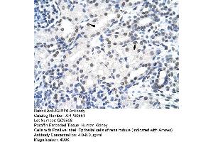 Rabbit Anti-SURF6 Antibody  Paraffin Embedded Tissue: Human Kidney Cellular Data: Epithelial cells of renal tubule Antibody Concentration: 4. (SURF6 抗体  (Middle Region))