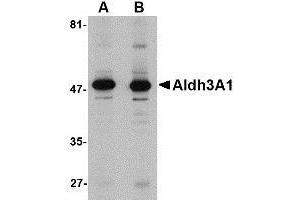Western blot analysis of Aldh3A1 in human stomach lysate with AP30043PU-N Aldh3A1 antibody at (A) 1 and (B) 2 μg/ml. (ALDH3A1 抗体  (C-Term))