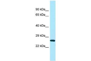 WB Suggested Anti-UQCC Antibody Titration: 1. (Ubiquinol-Cytochrome C Reductase Complex Chaperone (UQCC) (N-Term) 抗体)