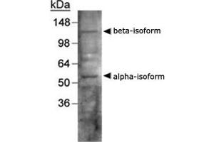 Western blot analysis of LXR in human liver using NR1H3/NR1H2 polyclonal antibody . (NR1H3 抗体  (AA 50-150))