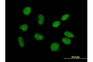 Immunofluorescence of purified MaxPab antibody to CGI-09 on HeLa cell. (TRMT6 抗体  (AA 1-497))