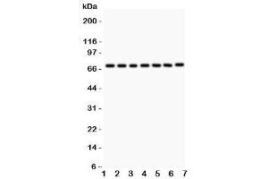 Western blot testing of FOXO3A antibody and Lane 1:  rat thymus (FOXO3 抗体  (AA 471-673))