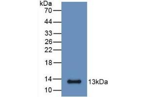 Detection of Recombinant S100A6, Mouse using Monoclonal Antibody to S100 Calcium Binding Protein A6 (S100A6) (S100A6 抗体  (AA 1-89))