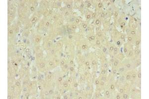 Immunohistochemistry of paraffin-embedded human liver tissue using ABIN7168454 at dilution of 1:100