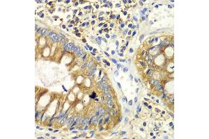 Immunohistochemistry of paraffin-embedded human colon using PICK1 antibody at dilution of 1:100 (x40 lens). (PICK1 抗体)