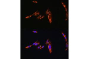 Immunofluorescence analysis of NIH/3T3 cells using A Rabbit pAb (ABIN6129944, ABIN6137377, ABIN6137378 and ABIN6224448) at dilution of 1:100. (AVPR1A 抗体  (AA 349-418))