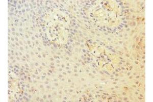 Immunohistochemistry of paraffin-embedded human tonsil tissue using ABIN7147204 at dilution of 1:100 (CD97 抗体  (AA 240-435))