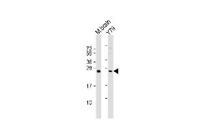 All lanes : Anti-VKORC1L1 Antibody (N-term) at 1:1000-1:2000 dilution Lane 1: mouse brain lysate Lane 2: Y79 whole cell lysate Lysates/proteins at 20 μg per lane.