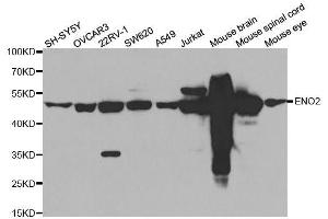 Western blot analysis of extracts of various cell lines, using ENO2 antibody. (ENO2/NSE 抗体)