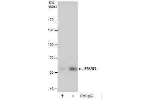 IP Image Immunoprecipitation of PFKFB3 protein from A431 whole cell extracts using 5 μg of PFKFB3 antibody [C3], C-term, Western blot analysis was performed using PFKFB3 antibody [C3], C-term, EasyBlot anti-Rabbit IgG  was used as a secondary reagent. (PFKFB3 抗体  (C-Term))