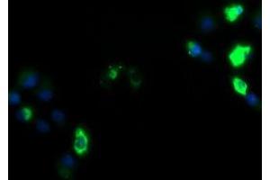 Image no. 3 for anti-Zinc Finger and SCAN Domain Containing 18 (ZSCAN18) antibody (ABIN1501858)