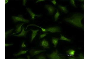 Immunofluorescence of monoclonal antibody to KLK2 on HeLa cell. (Kallikrein 2 抗体  (AA 1-262))