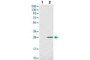 Western blot analysis of Lane 1: Negative control (vector only transfected HEK293T lysate), Lane 2: Over-expression Lysate (Co-expressed with a C-terminal myc-DDK tag (~3. (EBP 抗体)