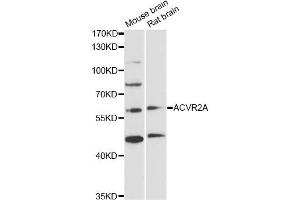 Western blot analysis of extracts of various cell lines, using ACVR2A antibody (ABIN5971030) at 1/1000 dilution. (ACVR2A 抗体)