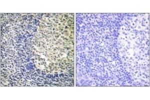 Immunohistochemistry analysis of paraffin-embedded human tonsil, using p47 phox (Phospho-Ser370) Antibody. (NCF1 抗体  (pSer370))