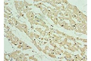 Immunohistochemistry of paraffin-embedded human heart tissue using ABIN7144071 at dilution of 1:100 (APC1 抗体  (AA 1-185))
