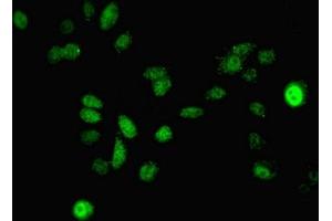 Immunofluorescent analysis of A549 cells using ABIN7150707 at dilution of 1:100 and Alexa Fluor 488-congugated AffiniPure Goat Anti-Rabbit IgG(H+L) (MAP2K3 抗体  (AA 1-347))
