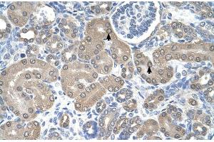 Human kidney (SSR1 抗体  (N-Term))