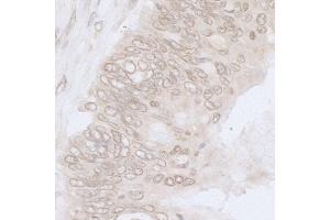 anti-Nucleoporin 35kDa (NUP35) (AA 276-376) antibody