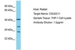 Image no. 1 for anti-Collectin Sub-Family Member 11 (COLEC11) (AA 20-69) antibody (ABIN6750556)