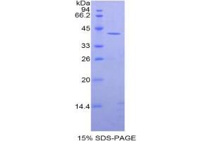 SDS-PAGE analysis of Rat CKM Protein. (CKM 蛋白)