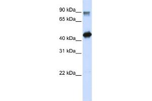 WB Suggested Anti-HMG20A Antibody Titration:  0. (HMG20A 抗体  (N-Term))