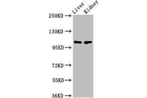 Western Blot Positive WB detected in: Rat liver tissue, Mouse kidney tissue All lanes: PEAR1 antibody at 5. (PEAR1 抗体  (AA 932-1037))