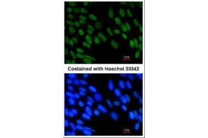 Immunofluorescence (IF) image for anti-Zinc Finger, MYM-Type 2 (ZMYM2) (Center) antibody (ABIN2856121)