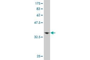 Western Blot detection against Immunogen (35. (LHX6 抗体  (AA 274-363))