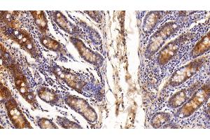 Immunohistochemistry (IHC) image for anti-Galectin 3 (LGALS3) (AA 1-250) antibody (ABIN7431560)