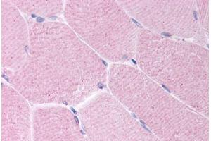 Human Skeletal Muscle (formalin-fixed, paraffin-embedded) stained with BARD1 antibody ABIN214634 at 10 ug/ml followed by biotinylated goat anti-rabbit IgG secondary antibody ABIN481713, alkaline phosphatase-streptavidin and chromogen. (BARD1 抗体  (AA 108-124))