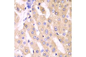 Immunohistochemistry (IHC) image for anti-Cytochrome P450, Family 3, Subfamily A, Polypeptide 4 (CYP3A4) (AA 244-503) antibody (ABIN3023346) (CYP3A4 抗体  (AA 244-503))
