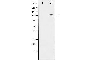 Western blot analysis of NMDAR1 expression in Jurkat whole cell lysates,The lane on the left is treated with the antigen-specific peptide. (GRIN1/NMDAR1 抗体  (C-Term))