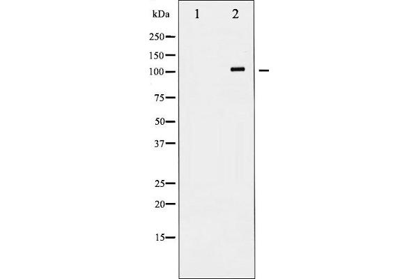GRIN1/NMDAR1 anticorps  (C-Term)
