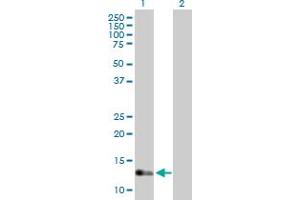 Western Blot analysis of IFT20 expression in transfected 293T cell line by IFT20 MaxPab polyclonal antibody.