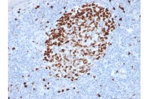 Immunohistochemistry (IHC) image for anti-Antigen Identified By Monoclonal Antibody Ki-67 (MKI67) (AA 2293-2478) antibody (ABIN6940053)