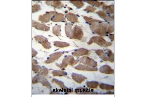 ACTN3 Antibody (Center) (ABIN656261 and ABIN2845575) immunohistochemistry analysis in formalin fixed and paraffin embedded human skeletal muscle followed by peroxidase conjugation of the secondary antibody and DAB staining. (ACTN3 抗体  (AA 409-437))