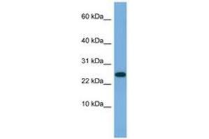Image no. 1 for anti-Ankyrin Repeat Domain 39 (ANKRD39) (AA 35-84) antibody (ABIN6745692) (ANKRD39 抗体  (AA 35-84))