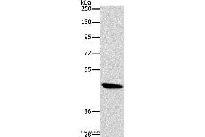 Western blot analysis of A172 cell, using BRS3 Polyclonal Antibody at dilution of 1:500 (BRS3 抗体)