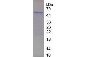 SDS-PAGE analysis of Rat WISP2 Protein. (WISP2 蛋白)