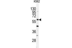 Western Blotting (WB) image for anti-Ubiquitin Specific Peptidase 2 (USP2) antibody (ABIN3001466) (USP2 抗体)