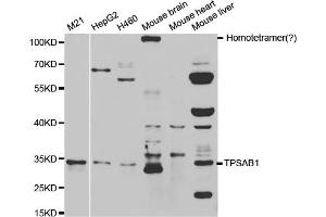Western blot analysis of extracts of various cell lines, using TPSAB1 antibody. (TPSAB1 抗体)