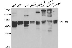 Western blot analysis of extracts of various cell lines, using TALDO1 antibody. (TALDO1 抗体)