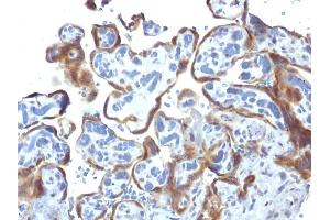 Formalin-fixed, paraffin-embedded human Placenta stained with TIMP2 Mouse Monoclonal Antibody (3A4) (TIMP2 抗体  (N-Term))