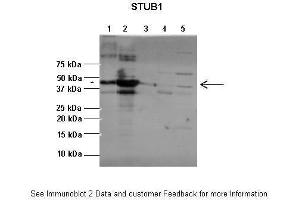 Lanes:   1:1ug insoluble STUB1 protein, 2:1ug soluble STUB1 protein, 3:1ug EPM2A protein, 4:1ug insoluble PPP1R3C protein, 5:1ug soluble PPP1R3C protein  Primary Antibody Dilution:   1:2500  Secondary Antibody:   Anti-rabbit-AP  Secondary Antibody Dilution:   1:20,000  Gene Name:   STUB1  Submitted by:   Pedro Castanheira, Biocant (STUB1 抗体  (C-Term))