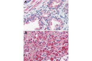 Immunohistochemical staining of formalin-fixed, paraffin-embedded human prostate (A) and human adrenal gland (B) tissue after heat-induced antigen retrieval. (CCKAR 抗体  (Internal Region))