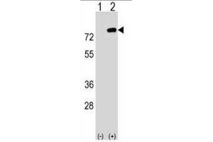 Western blot analysis of PBXIP1 (arrow) using rabbit polyclonal PBXIP1 Antibody (C-term) . (PBXIP1 抗体  (C-Term))