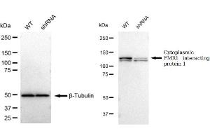 Western blotting analysis using Cytoplasmic FMR1 interacting protein 1 antibody (ABIN7798264). (Recombinant CYFIP1 抗体)