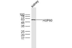 Mouse kidney lysates probed with Rabbit Anti-HSP60 Polyclonal Antibody  at 1:300 overnight at 4˚C. (HSPD1 抗体  (AA 501-573))