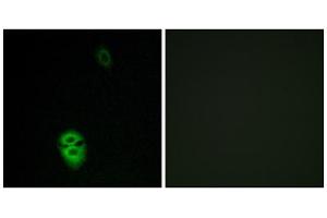 Immunofluorescence analysis of Jurkat cells, using OR4K17 antibody. (OR4K17 抗体  (C-Term))